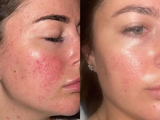 Original Centella Asiatica