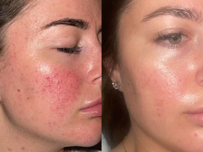 Original Centella Asiatica