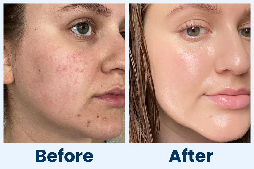 Original Centella Asiatica