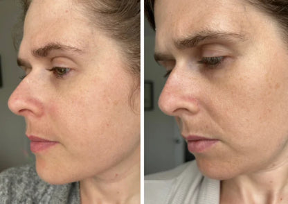 Retinal Night Cream