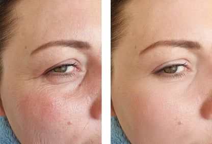 Retinal Night Cream
